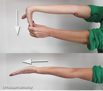 ejercicios de estiramiento: Flexiona la muñeca todo lo que se pueda hacia abajo sujetándola con la otra mano. Estirar por completo el codo girando el antebrazo hacia dentro. Mantener así 15 segundos y repetir varias veces al cabo del día.